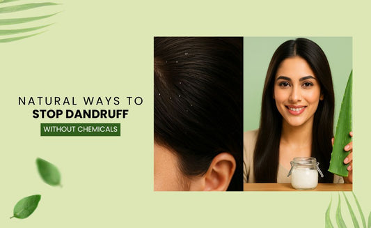 Natural Dandruff Treatment in Pakistan – No Chemicals, Just Results - Hairganic