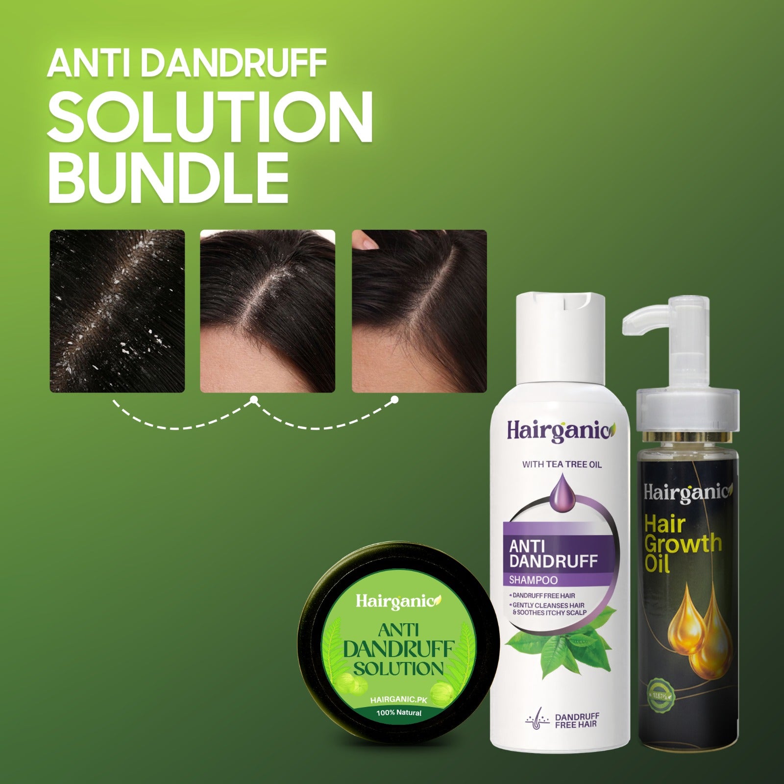 Hairganic anti dandruff solution bundle with shampoo, oil, and hair mask solution